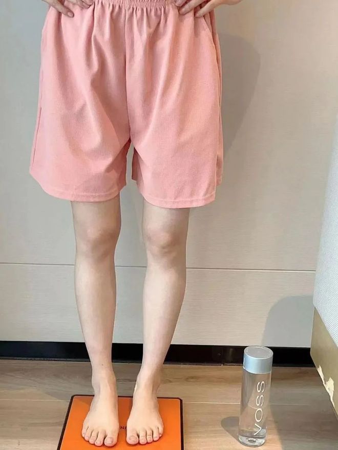 断腿体重还是不掉？真相扎心了…pg电子免